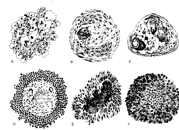 granuloma.JPG (122285 oCg)